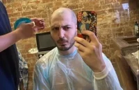 Иосиф Оганесян рассказал детали о процедуре пересадки волос.