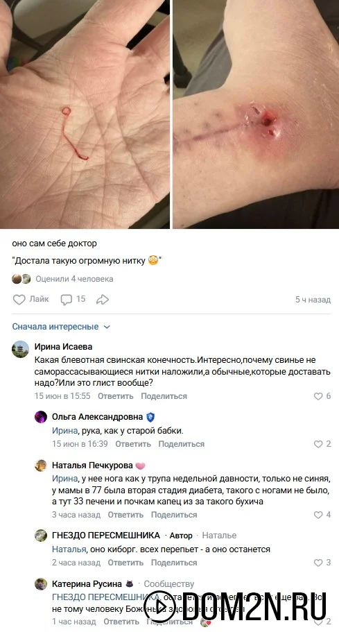 жуткая болячка на теле Александры Черно